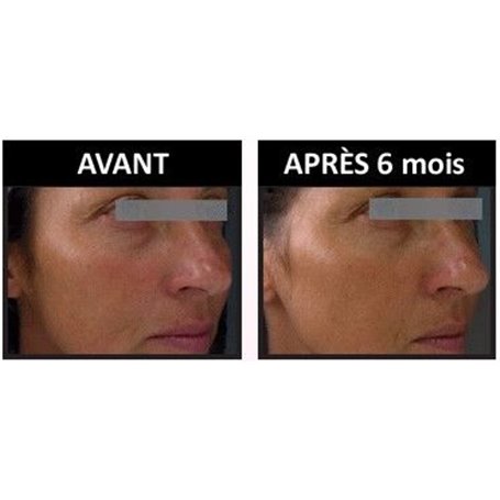 Soin Anti-Age Correcteur des Rides et des Tâches Institut Claude Bell - 2