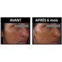 Anti-Aging Corrective Care for Wrinkles and Dark Spots Institut Claude Bell - 2