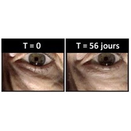 Soin Anti-Poches Correcteur des Poches Sous les Yeux Institut Claude Bell - 3