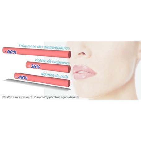 Rp Visage Epil Xpress Hair Reduction Lotion For The Face