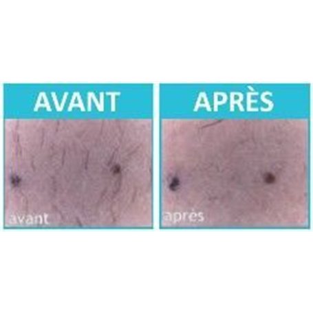 Epil Xpress Lotion Réducteur de Pilosité pour le Visage Institut Claude Bell - 5