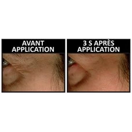 Flash Coup d'Eclat du Regard Pattes d'Oie Rides et Ridules Institut Claude Bell - 3