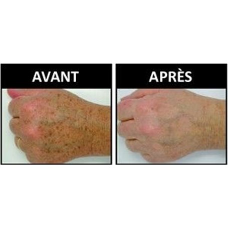 R.B.S. Soin Correcteur des Taches Brunes Institut Claude Bell - 2