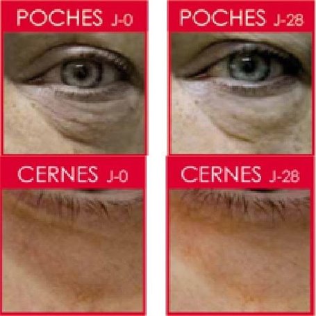 lumin poches correcteur