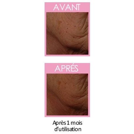 S.R.J.9 Soin Restructurant des Joues Femme Institut Claude Bell - 2