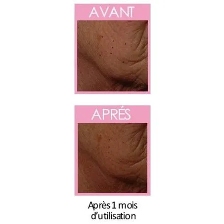S.R.J.9 Soin Restructurant des Joues Femme Institut Claude Bell - 2