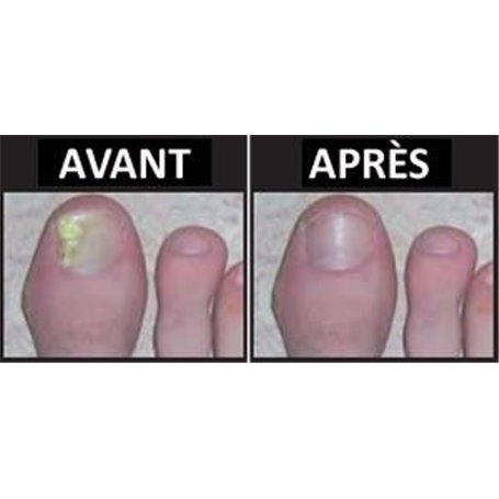 Soin de l'Ongle pour Revitaliser et Renforcer les Ongles Institut Claude Bell - 4