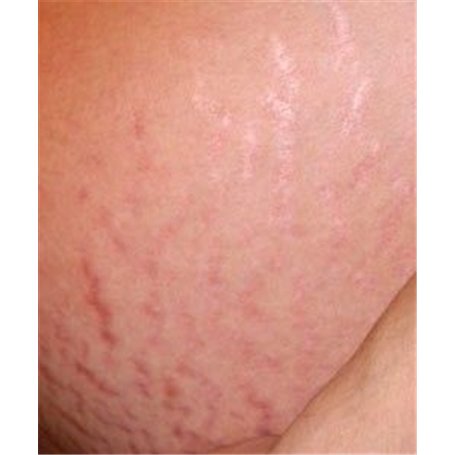 Argan Oil Triple-Action Anti-Vergetures à l'Huile d'Argan Renforce l'Elasticité de la Peau Institut Claude Bell - 5